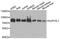 Suv3 Like RNA Helicase antibody, A9951, ABclonal Technology, Western Blot image 