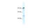 Zinc Finger Protein 227 antibody, 28-470, ProSci, Enzyme Linked Immunosorbent Assay image 