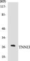 Troponin I3, Cardiac Type antibody, EKC1569, Boster Biological Technology, Western Blot image 