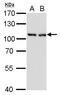 Chromosome Segregation 1 Like antibody, MA5-18303, Invitrogen Antibodies, Western Blot image 