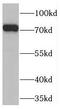 TNFAIP3 Interacting Protein 1 antibody, FNab08831, FineTest, Western Blot image 