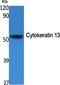 Keratin 13 antibody, A04299, Boster Biological Technology, Western Blot image 