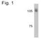 Adaptor Related Protein Complex 2 Subunit Beta 1 antibody, NB100-74371, Novus Biologicals, Western Blot image 