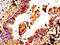 Cystatin A antibody, LS-C369457, Lifespan Biosciences, Immunohistochemistry frozen image 