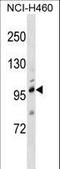 Transient Receptor Potential Cation Channel Subfamily C Member 1 antibody, LS-C160227, Lifespan Biosciences, Western Blot image 
