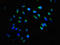 Acyl-CoA Binding Domain Containing 3 antibody, LS-C675102, Lifespan Biosciences, Immunofluorescence image 