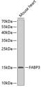 Fatty Acid Binding Protein 3 antibody, 13-329, ProSci, Western Blot image 