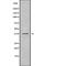 Beta-1,3-Galactosyltransferase 6 antibody, abx148493, Abbexa, Western Blot image 