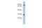 KN Motif And Ankyrin Repeat Domains 3 antibody, GTX45174, GeneTex, Western Blot image 