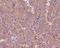 Tubulin Beta 3 Class III antibody, M01857-1, Boster Biological Technology, Immunohistochemistry paraffin image 