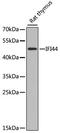 Interferon Induced Protein 44 antibody, A8188, ABclonal Technology, Western Blot image 