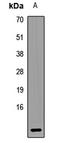 Ubiquinol-Cytochrome C Reductase Complex III Subunit VII antibody, LS-C668484, Lifespan Biosciences, Western Blot image 