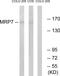 ATP Binding Cassette Subfamily C Member 10 antibody, GTX87120, GeneTex, Western Blot image 