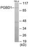 PiggyBac Transposable Element Derived 1 antibody, EKC1900, Boster Biological Technology, Western Blot image 