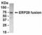 Endoplasmic Reticulum Protein 29 antibody, XW-8133, ProSci, Western Blot image 