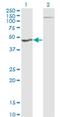 Homogentisate 1,2-Dioxygenase antibody, H00003081-M11, Novus Biologicals, Western Blot image 