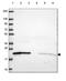 ADP Ribosylation Factor Like GTPase 1 antibody, PA5-64479, Invitrogen Antibodies, Western Blot image 