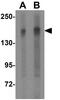 TSC Complex Subunit 2 antibody, GTX31287, GeneTex, Western Blot image 