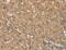 Ring Finger Protein 148 antibody, MBS2523185, MyBioSource, Immunohistochemistry paraffin image 