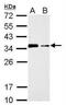 Cytokine Inducible SH2 Containing Protein antibody, NBP1-30943, Novus Biologicals, Western Blot image 