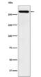 TATA-Box Binding Protein Associated Factor 1 antibody, M02151, Boster Biological Technology, Western Blot image 