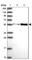 Pyruvate Dehydrogenase Kinase 3 antibody, HPA046583, Atlas Antibodies, Western Blot image 