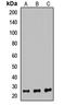 Proteasome Subunit Beta 6 antibody, LS-C667981, Lifespan Biosciences, Western Blot image 