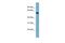 Alanine--Glyoxylate Aminotransferase 2 antibody, PA5-43259, Invitrogen Antibodies, Western Blot image 