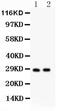 Linker For Activation Of T Cells antibody, PA5-79583, Invitrogen Antibodies, Western Blot image 