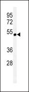 Cholinergic Receptor Nicotinic Alpha 3 Subunit antibody, 61-758, ProSci, Western Blot image 