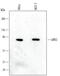 G Protein-Coupled Receptor Kinase 3 antibody, MAB4785, R&D Systems, Western Blot image 