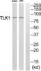 Tousled Like Kinase 1 antibody, abx015172, Abbexa, Western Blot image 