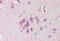 F-box/LRR-repeat protein 2 antibody, MBS248689, MyBioSource, Immunohistochemistry paraffin image 