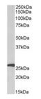 Complement Factor D antibody, orb334064, Biorbyt, Western Blot image 