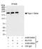 DNA Topoisomerase II Beta antibody, A300-950A, Bethyl Labs, Immunoprecipitation image 