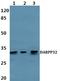 Protein Phosphatase 1 Regulatory Inhibitor Subunit 1B antibody, A03424, Boster Biological Technology, Western Blot image 