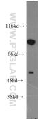 Gamma-Aminobutyric Acid Type A Receptor Beta1 Subunit antibody, 20183-1-AP, Proteintech Group, Western Blot image 