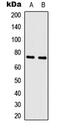 MYB Proto-Oncogene, Transcription Factor antibody, MBS8240689, MyBioSource, Western Blot image 