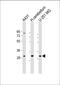 BCDIN3 Domain Containing RNA Methyltransferase antibody, 61-351, ProSci, Western Blot image 