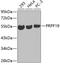 Pre-MRNA Processing Factor 19 antibody, 19-063, ProSci, Western Blot image 