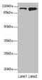 Mov10 RISC Complex RNA Helicase antibody, CSB-PA862068LA01HU, Cusabio, Western Blot image 