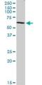 Coronin 2B antibody, H00010391-B01P, Novus Biologicals, Western Blot image 