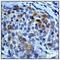 Aurora Kinase A antibody, ab52973, Abcam, Immunohistochemistry paraffin image 