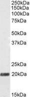 Stathmin 2 antibody, GTX89696, GeneTex, Western Blot image 