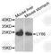 Lymphocyte Antigen 86 antibody, A6185, ABclonal Technology, Western Blot image 