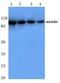 Glutamate Ionotropic Receptor Kainate Type Subunit 2 antibody, AP06141PU-N, Origene, Western Blot image 