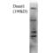 DNA Methyltransferase 1 antibody, NBP2-59344, Novus Biologicals, Western Blot image 