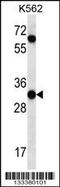 Peptidase Inhibitor 15 antibody, 56-994, ProSci, Western Blot image 