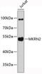 Makorin Ring Finger Protein 2 antibody, 19-416, ProSci, Western Blot image 