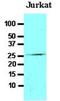 Fas Associated Via Death Domain antibody, NBP1-04288, Novus Biologicals, Western Blot image 